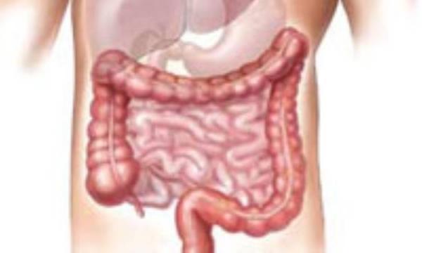 قولنج روده (دل پیچه) قولنج روده (دل پیچه یا دردهای حاد و متواتر شکمی) بچه ها