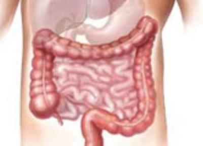 قولنج روده (دل پیچه یا دردهای حاد و متواتر شکمی) بچه ها