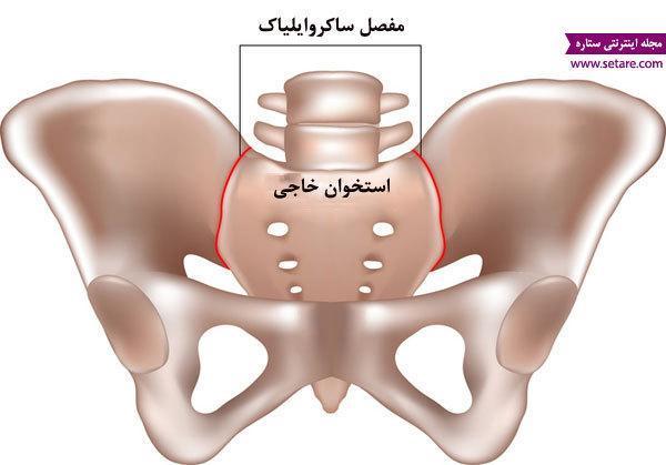 علت کمر درد در بارداری چیست و چگونه درمان می شود؟