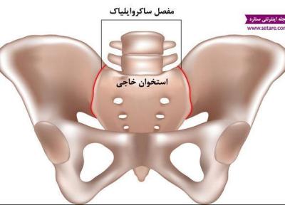 علت کمر درد در بارداری چیست و چگونه درمان می شود؟