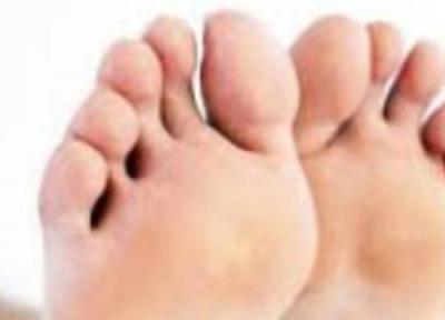 چگونه از پوست پاهایمان مراقبت کنیم؟