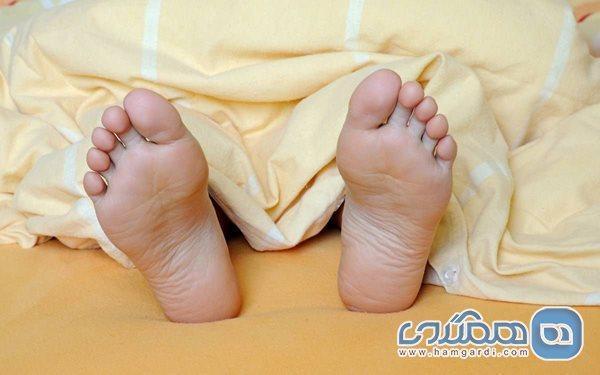 علت زردی کف پاها چیست؟ علت زردی کف پاها چیست؟