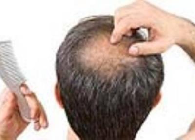 علل بروز آلوپسی اره اتا