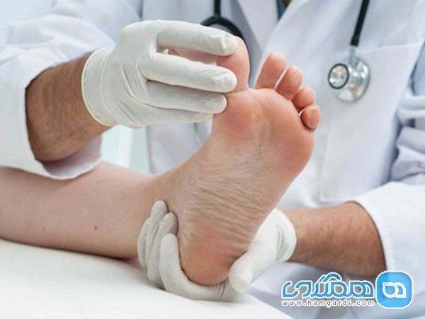 تمرین های ورزشی برای بهتر شدن قوز شست پا تمرین های ورزشی برای بهتر شدن قوز شست پا