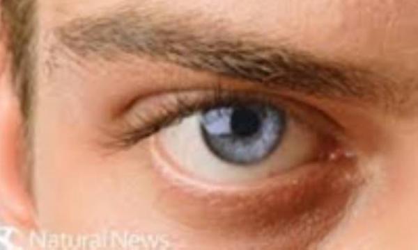 ویتامین های ضروری جهت حفظ سلامت چشم