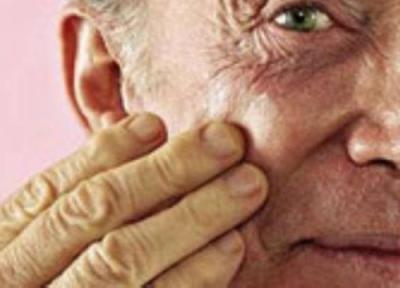 پیری زودرس؛ نوعی دیگر