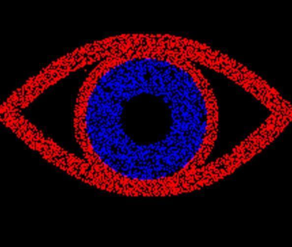 کروموسترئوپسیس چه نوع توهم بینایی است؟